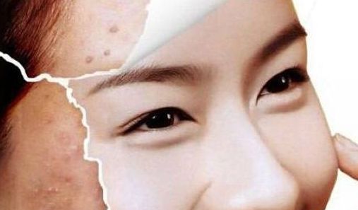 廣州整形注射隆鼻哪家好？綜合用戶評價，推薦這家！