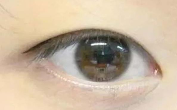 連云港市哪家美容醫(yī)院口碑好？