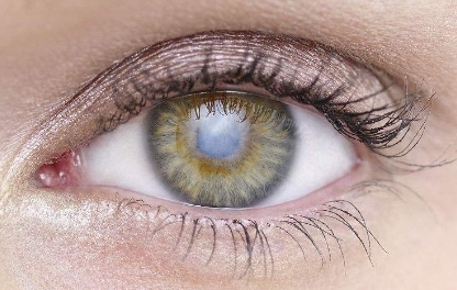 瘦臉手術(shù)的價(jià)格有哪些影響因素？有什么選擇嗎？