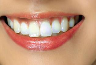 施悅吸脂靠譜嗎？是否值得一試