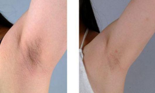 杭州瘦腿針醫(yī)院哪家好？選杭州瘦腿針醫(yī)院一定不要錯(cuò)過這些關(guān)鍵因素！