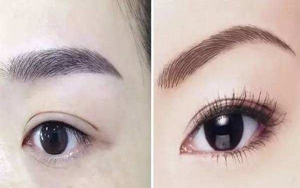 怎樣去除皺紋？忘記肌膚年齡，煥發(fā)青春活力!