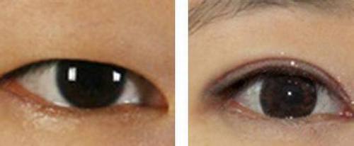 南京消除川字紋醫(yī)院TOP10！2023年很受好評的正規(guī)整形機(jī)構(gòu)揭曉