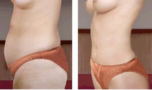 武漢祛眼袋醫(yī)院哪家好？2023最新排名出爐，專家推薦！