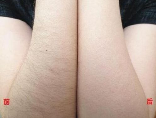 長沙整形專家，專攻隆胸、祛斑、除皺等手術(shù)！驚喜價格揭曉！