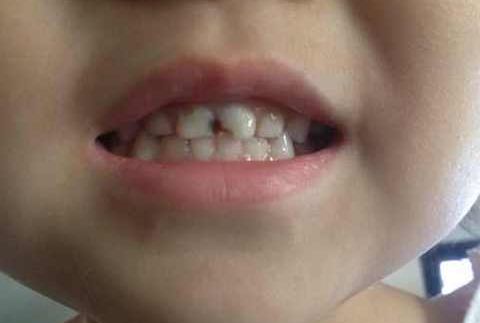 新疆哪家整容醫(yī)院隆鼻效果最佳，值得推薦？