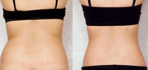 上海哪家青春痘治療效果好？探討多種治療方法，為您提供最佳選擇