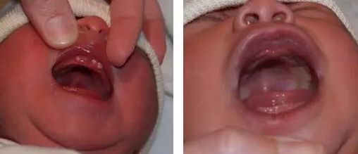 「2023年濮陽看痔瘡哪家醫(yī)院好？專家推薦+多人口碑回訪」