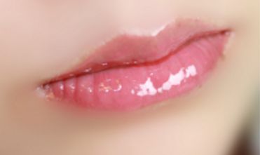 上海去除疤痕的醫(yī)院排名及評論：哪家醫(yī)院去傷疤效果好