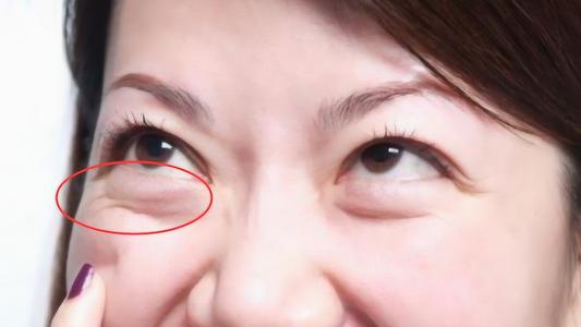 四物湯真的能美白祛斑嗎？四物湯的成分有哪些？揭秘！