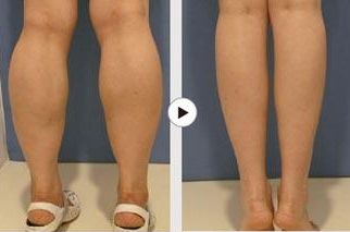 金華去痘印哪家醫(yī)院好？淺談金華地區(qū)專業(yè)的去痘印醫(yī)療機(jī)構(gòu)