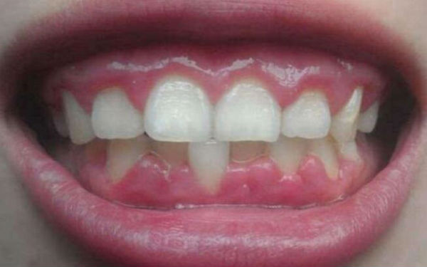 2023南京超聲溶脂去雙下巴哪家醫(yī)院效果好？榜單前10強醫(yī)療美容機構(gòu)呈現(xiàn)新交替！