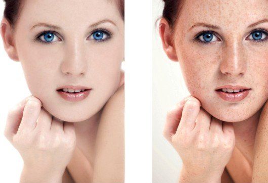 揭秘杭州哪家醫(yī)院能有效去除曬斑，為您推薦專(zhuān)業(yè)治療方案