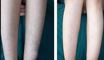 長春微整形醫(yī)院哪家技術好且口碑好？