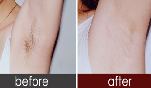 淮北哪家醫(yī)院雙眼皮效果好？找到最適合您的醫(yī)院