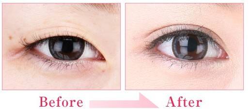 重慶哪家醫(yī)療美容醫(yī)院效果比較好？2023年重慶激光祛除紅胎記排名榜top10權(quán)威醫(yī)院大揭秘！