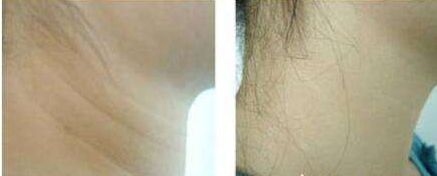 烏魯木齊眼科綜合哪家醫(yī)院好？專家告訴你最權威的選擇！