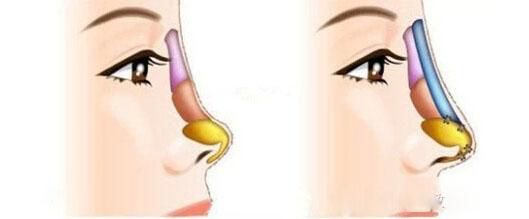 武漢市做雙眼皮哪家好？-經驗豐富的專業(yè)整形醫(yī)院推薦