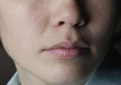 2023年青島十佳醫(yī)療整形醫(yī)院排行榜出爐，祛痣效果哪家比較好？