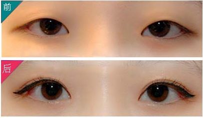 成都比較優(yōu)秀的隆鼻整形權(quán)威迎來(lái)巔峰表現(xiàn)！醫(yī)術(shù)高超技能卓越提升！