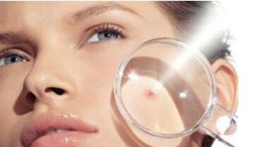 面部傷口傷疤修復(fù)是否能完美痊愈？