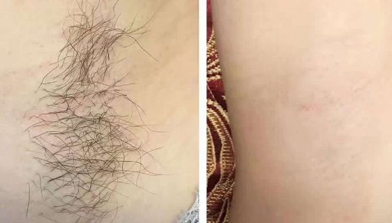 蚌埠私密整形哪家醫(yī)院好？選擇私密整形醫(yī)院時需注意哪些因素？