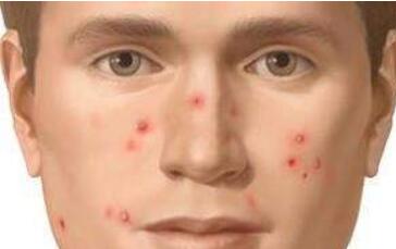 如何進行雙眼皮手術(shù)操作？