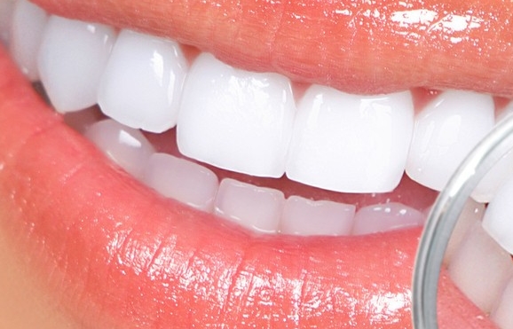 2023年溫州脈沖強(qiáng)光祛除黃褐斑好評醫(yī)院推薦