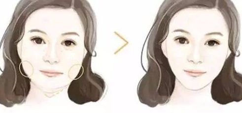 上海鼻子矯正哪家醫(yī)院好？了解上海鼻子矯正費(fèi)用和手術(shù)效果的綜合分析