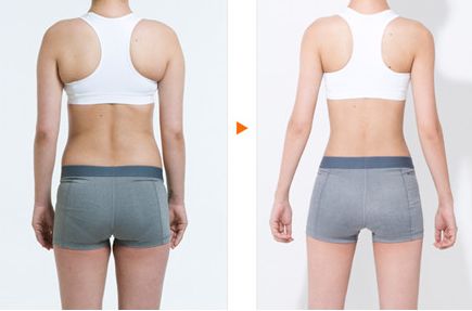 銀川熱瑪吉哪家做得好？揭秘銀川市熱瑪吉醫(yī)療美容機構排行榜！