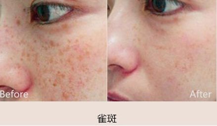 成都胸部整形醫(yī)院哪家最靠譜？