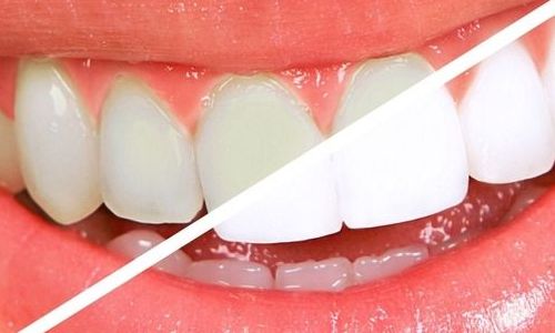 廣州激光整形醫(yī)院排名2023年最新評(píng)比，哪家好？