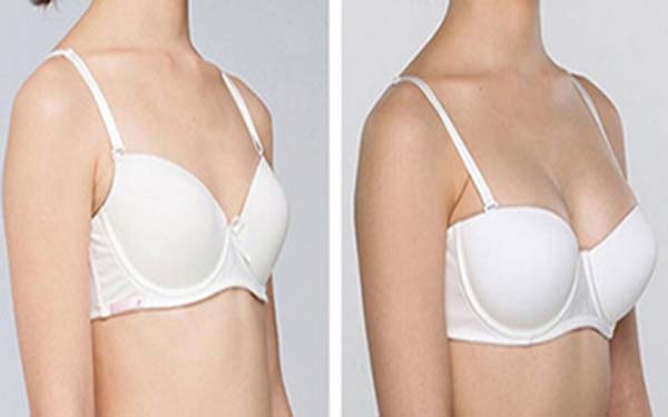 眼角紋的形成原因是什么？如何有效去除？