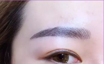 西安專業(yè)去眼袋醫(yī)院，在線搶先西安醫(yī)美機構登頂!