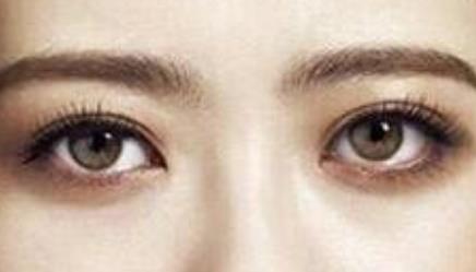 假體隆胸和注射隆胸哪個(gè)更適合？優(yōu)缺點(diǎn)對比后該如何選擇？