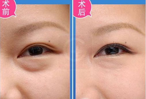 溫州哪家醫(yī)院做整形好？整形醫(yī)院排行榜解析