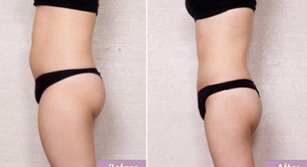 無(wú)錫眼睛整形醫(yī)院哪家好？教你如何選擇無(wú)錫最靠譜的眼部整形醫(yī)院