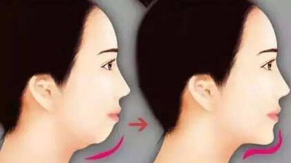 假體隆鼻手術(shù)操作原理是否有效？效果如何？