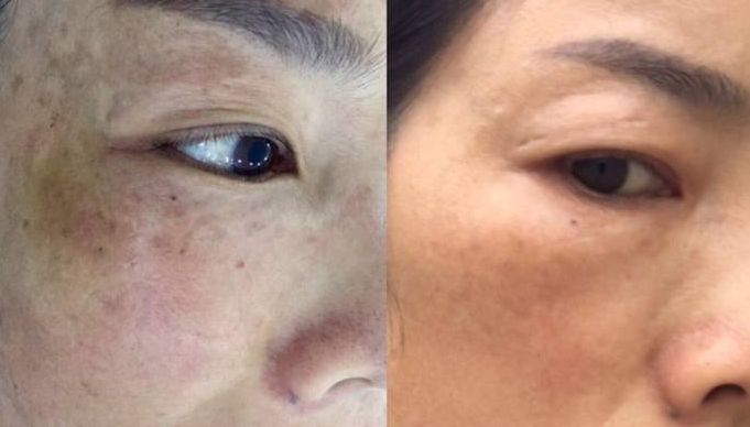 瀘州狐臭手術(shù)哪家醫(yī)院好？選擇時(shí)需關(guān)注的重要因素有哪些？