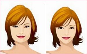 手臂吸脂術(shù)術(shù)后需要注意哪些事項？手臂吸脂術(shù)的效果如何呢？