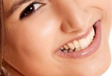 林恩京的整容傳聞：真相大揭！她到底動(dòng)了哪些項(xiàng)目？