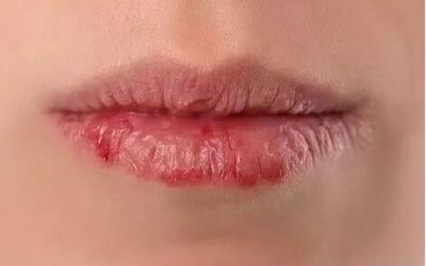 西安非常受歡迎的削下頜角醫(yī)療美容醫(yī)院推薦