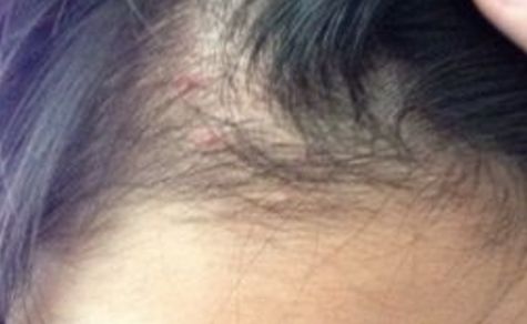 福州市中醫(yī)院美容中醫(yī)科簡介，首選之一！