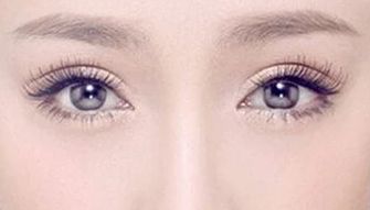 林珍娜整容后，煥然一新，她的變化令人驚嘆！