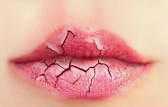 濟南的華美拉皮手術(shù)有效嗎？