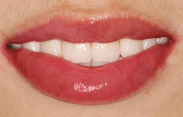 泰安第四人民醫(yī)院激光美容整形科醫(yī)院團(tuán)隊(duì)的技術(shù)怎么樣？整形科醫(yī)生水平如何？