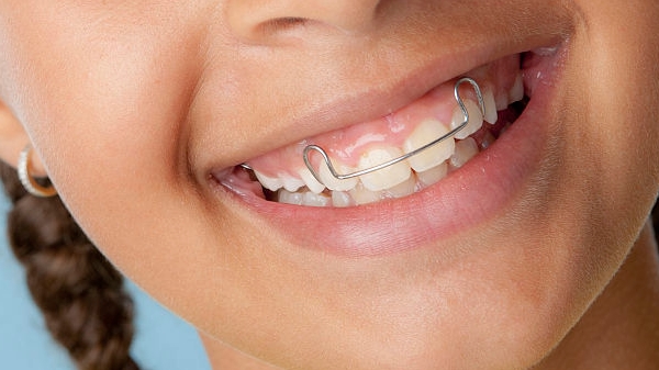 溫州東華醫(yī)院整形科價(jià)格表2023版！隆鼻案例：經(jīng)過(guò)整形手術(shù)，她變得更美了嗎？