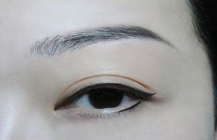 東莞哪家割雙眼皮醫(yī)院排第四？維多利亞醫(yī)療美容不是唯一選擇