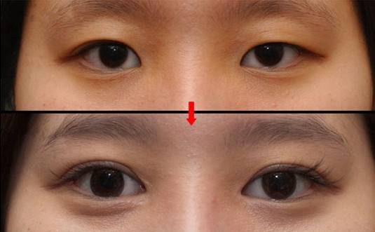 2023杭州大腿抽脂吸脂高推薦度醫(yī)院排名，十大醫(yī)美中心等你選！