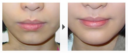 沈陽皮膚美容醫(yī)院排名TOP10，哪家好？